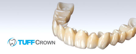 TuffCrown - Aligner, Emax, Zirconia